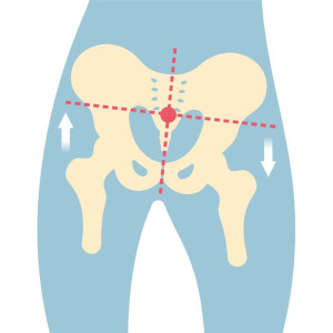 骨盤の歪み
