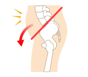 骨盤前傾